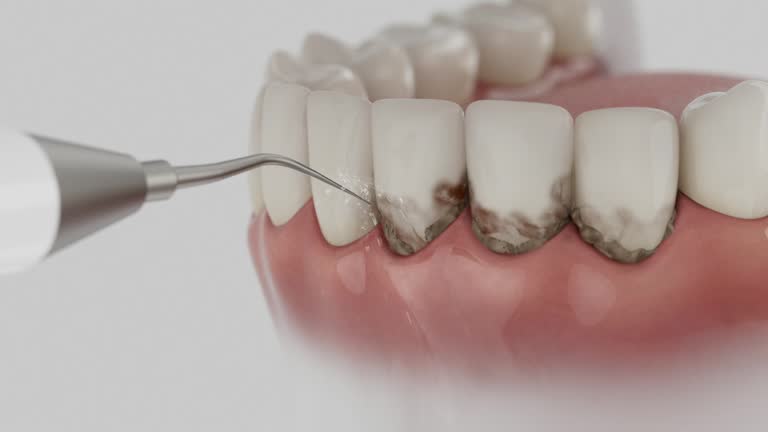 Trusted Teeth Cleaning And Checkup service in South Run, VA - Dentist Open Now